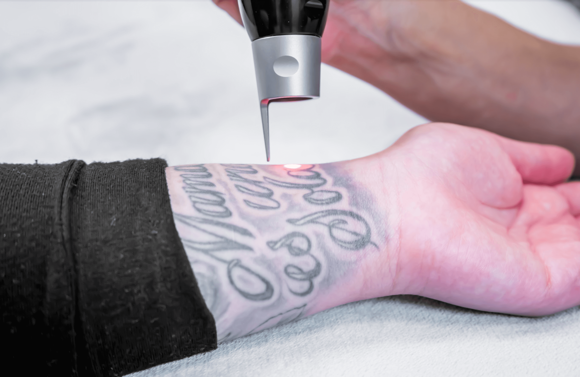Proper Aftercare Instructions for Laser Tattoo Removal  Rochester Tattoo  Removal